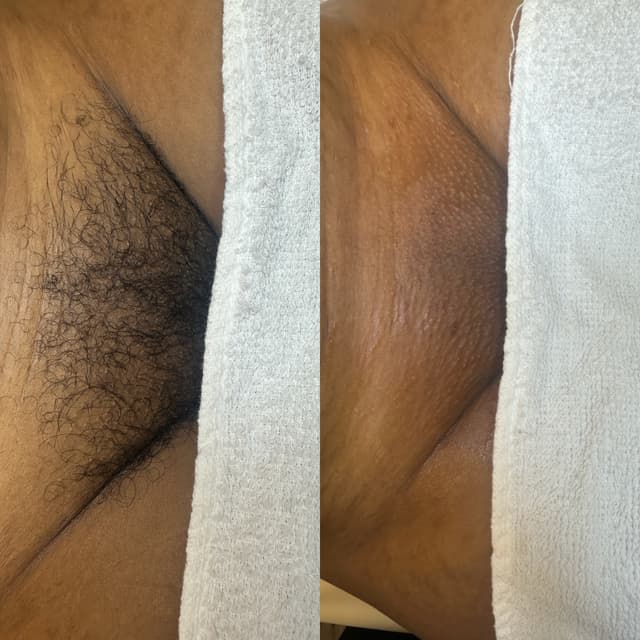Brazilian Wax Pass at CurrentGlow Esthetics in Redford, MI